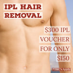 IPL Painless Hair Removal - $300 Voucher for only $150